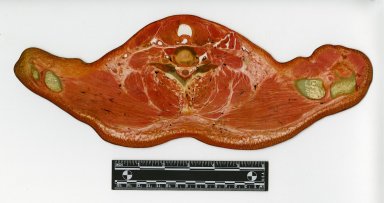 Cross section at shoulders