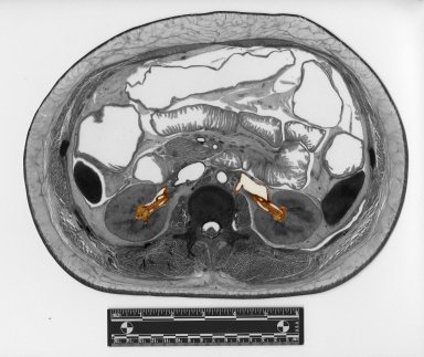 Cross section at kidneys