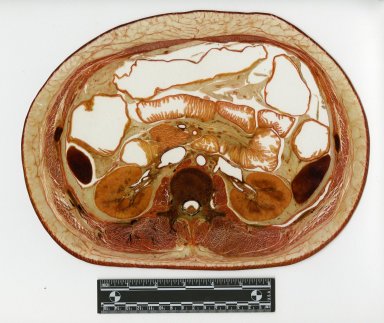 Cross section at kidneys