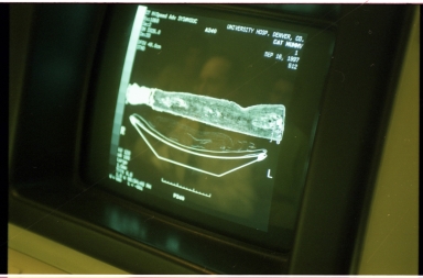 Computer screens during CT scan of cat mummy