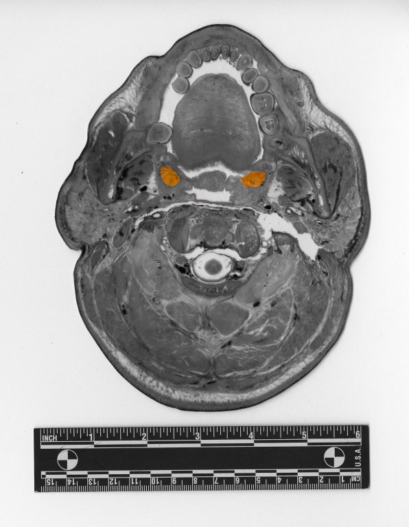 Cross section at head